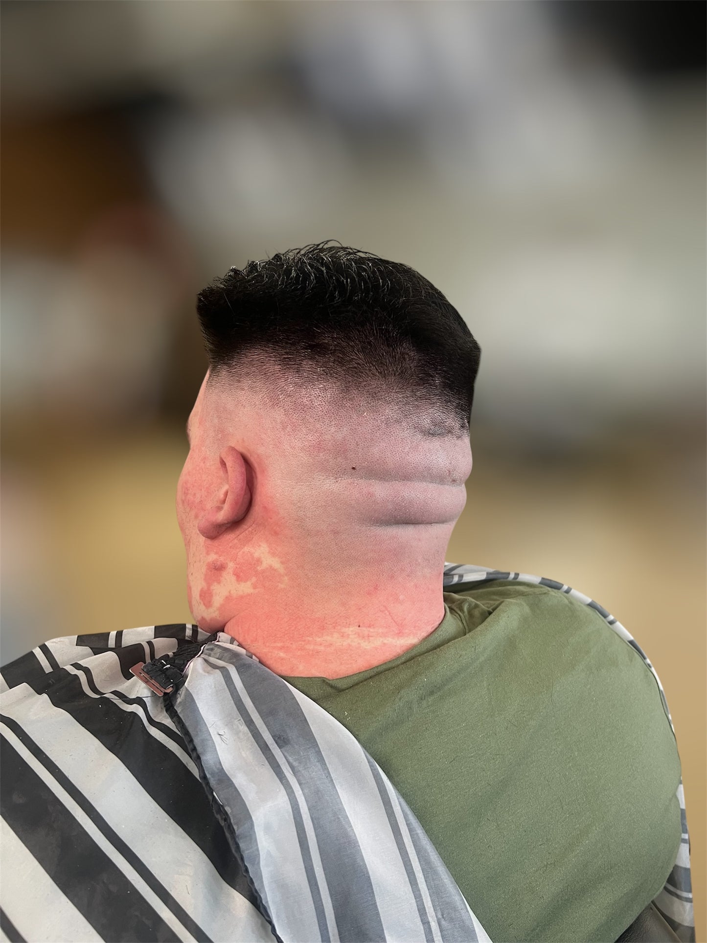 Bald fade