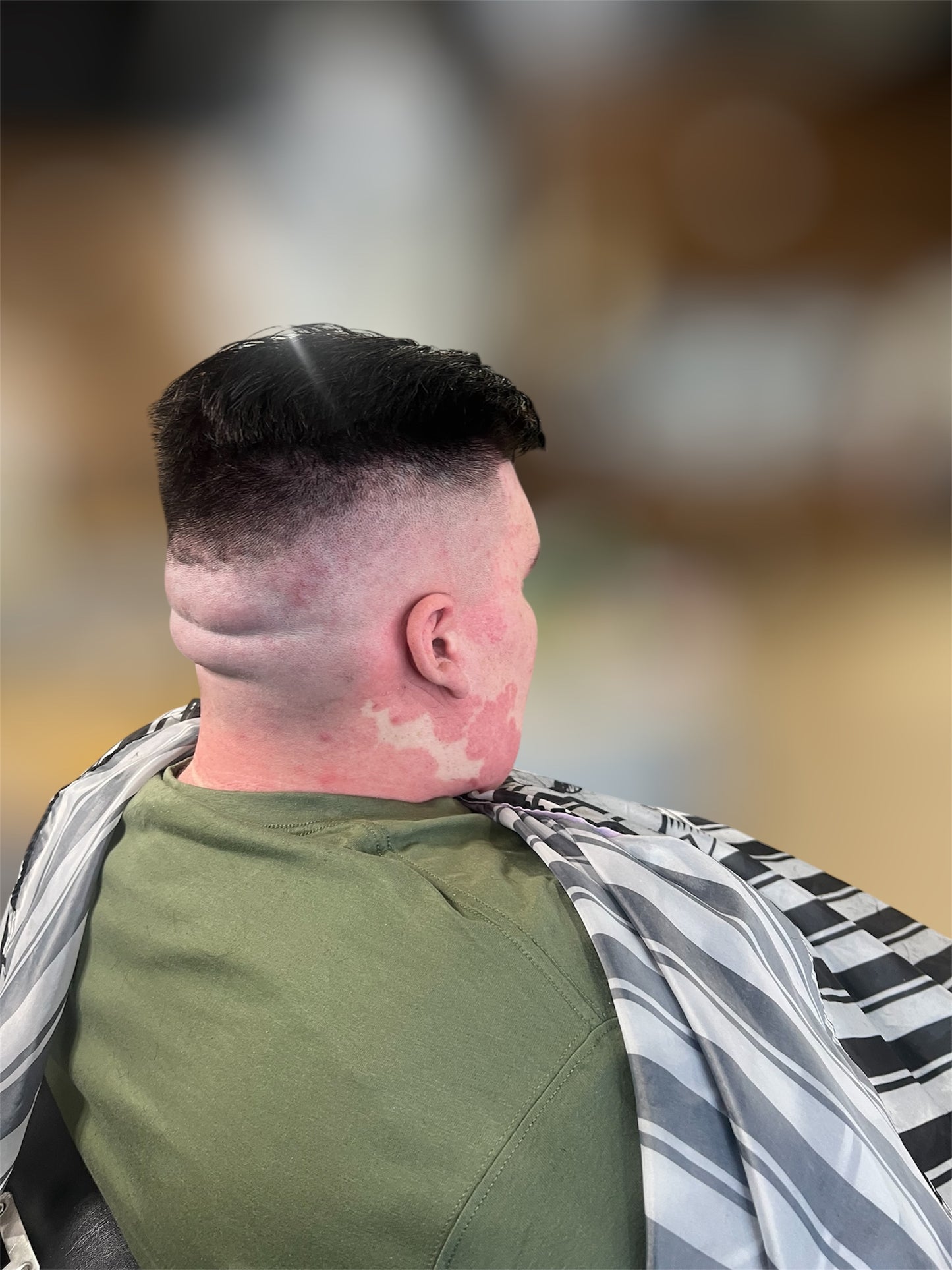 Bald fade