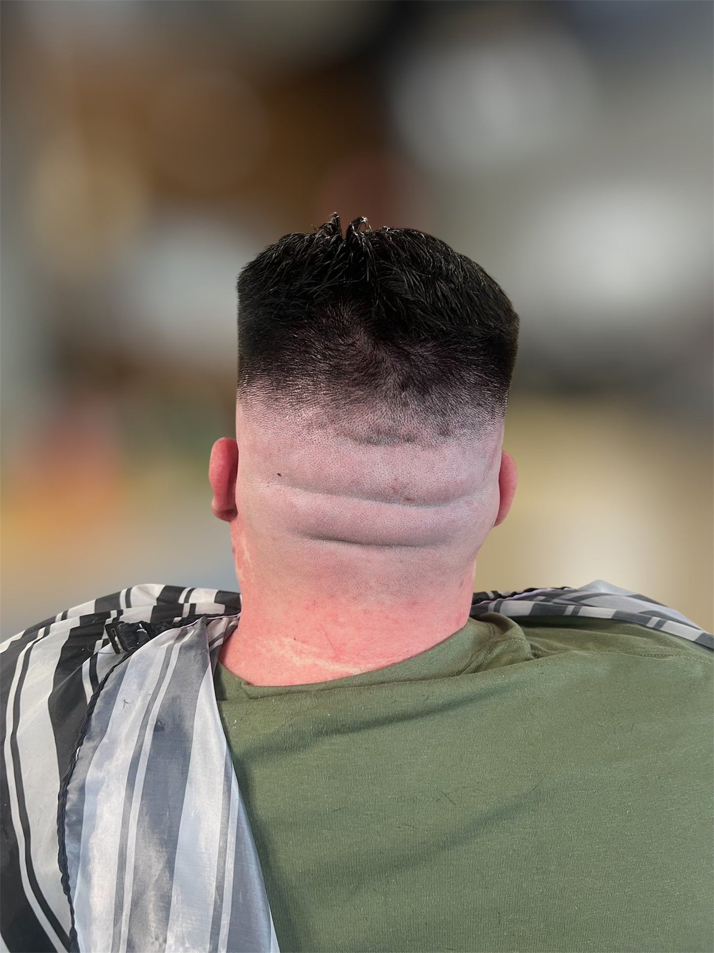Bald fade